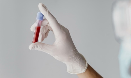 Боязнь крови